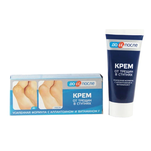 Kem Trị Nứt Gót Chân Kpem Chính Hãng Nga